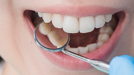 TEETH-GRINDING TEETH-GRINDING