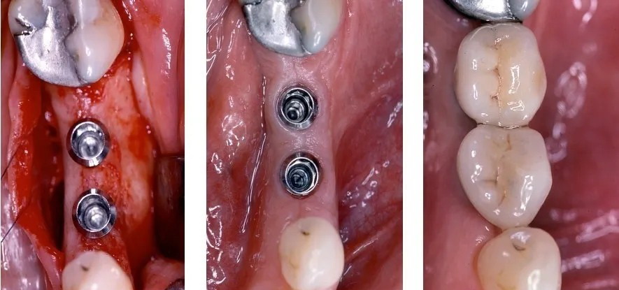 5d414e111e0b0bd6.jpg 5d414e111e0b0bd6.jpg