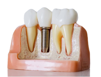 image-22.png image-22.png