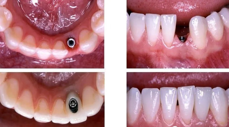 92329dabcefc1b7c.jpg 92329dabcefc1b7c.jpg