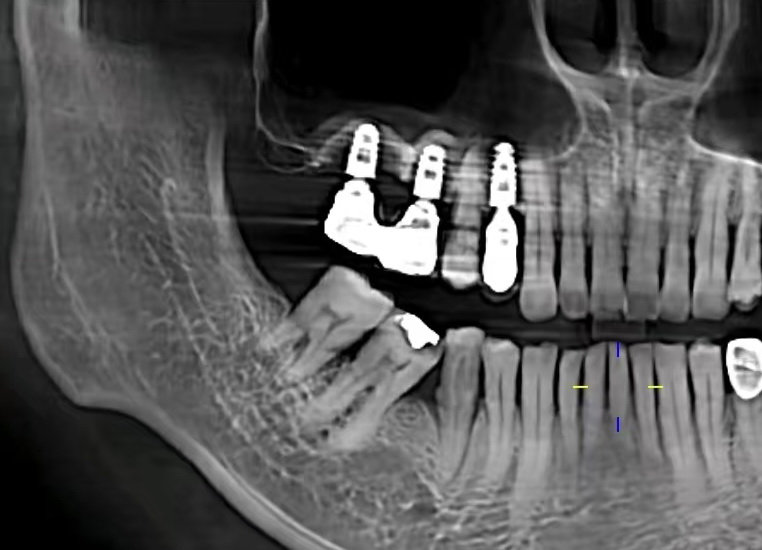 ba7(2).jpg ba7(2).jpg