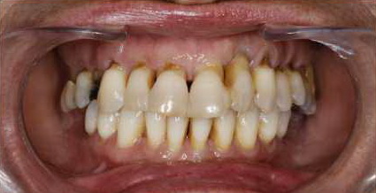 Periodontal.jpg Periodontal.jpg