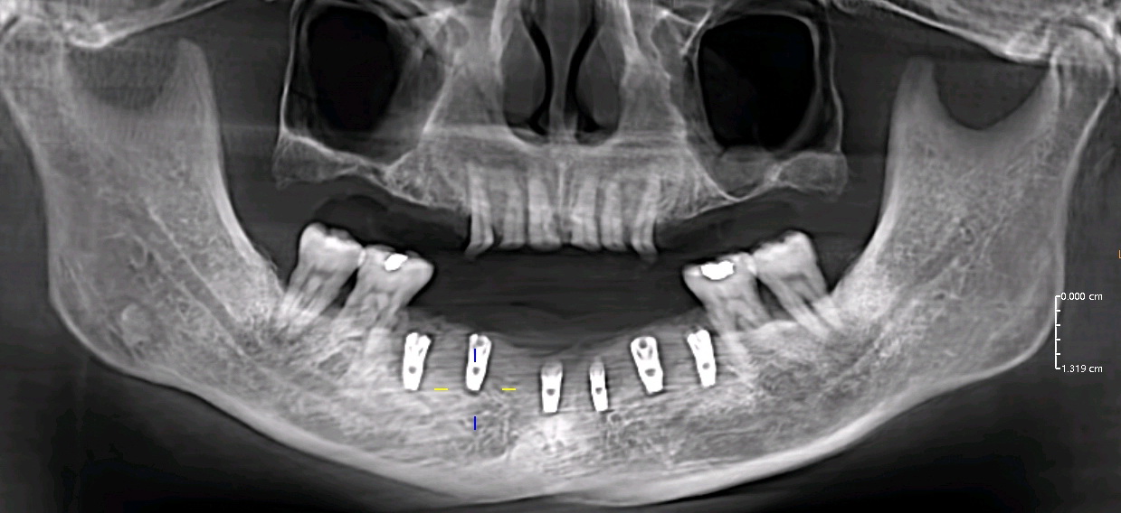 微信图片_20250420101839 微信图片_20250420101839
