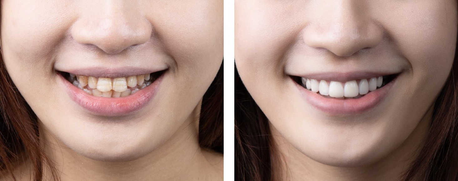 前學案例說明_page-0009.jpg 前學案例說明_page-0009.jpg