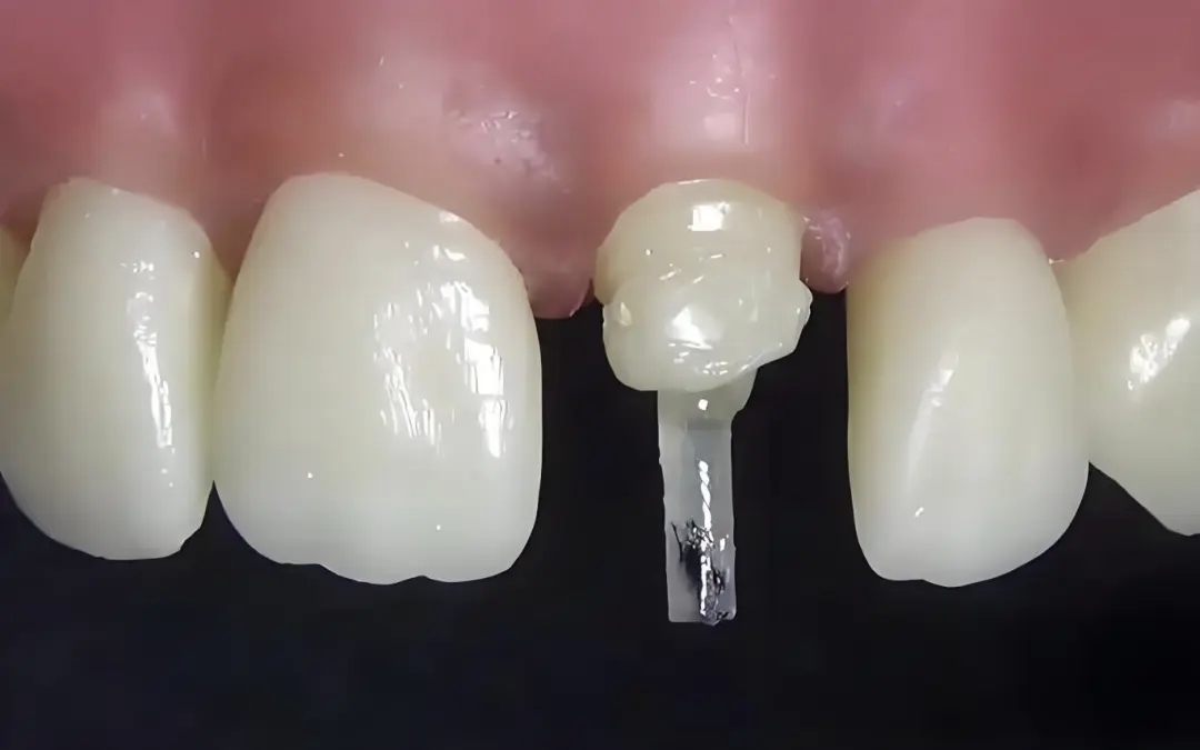 151b588845b7ef5ffbfa21d42fd9793.jpg 151b588845b7ef5ffbfa21d42fd9793.jpg