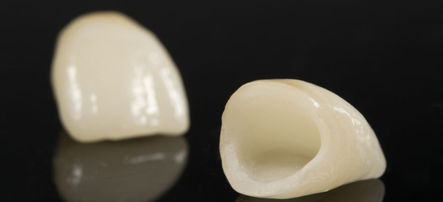 bd121d9325e9129bded577e87d6e75f bd121d9325e9129bded577e87d6e75f