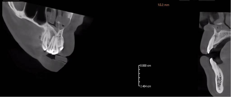 ill defined ill defined