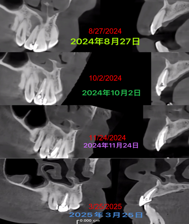 all radiograph all radiograph