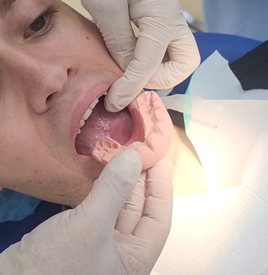 impression Taking 1.jpg impression Taking 1.jpg