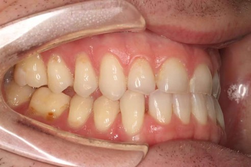 original right.jpg original right.jpg