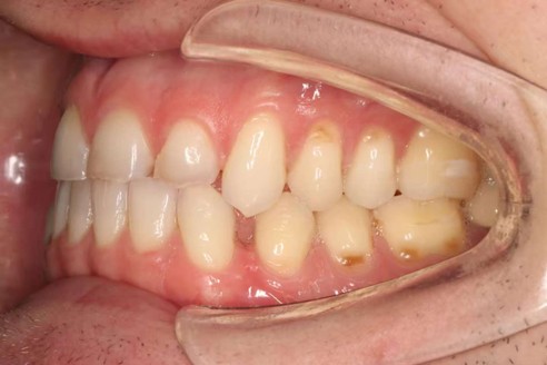 original left.jpg original left.jpg