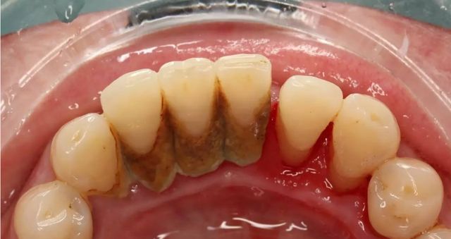 R-C (2).jpg R-C (2).jpg